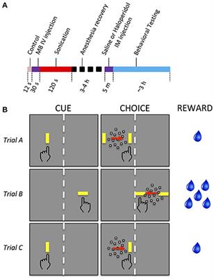 Toward a Cognitive Neural Prosthesis Using Focused Ultrasound